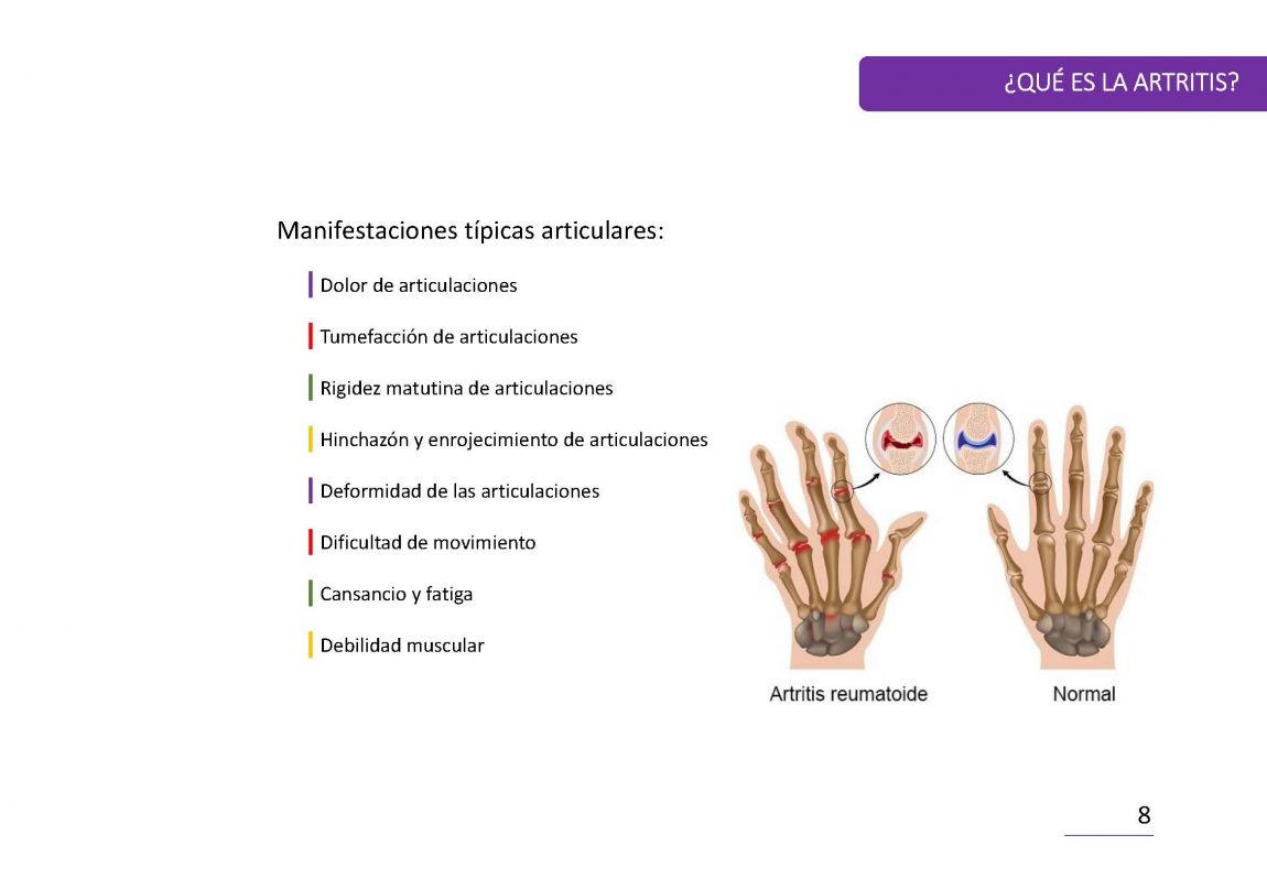 ArtritisReumatoide PaÌgina 08