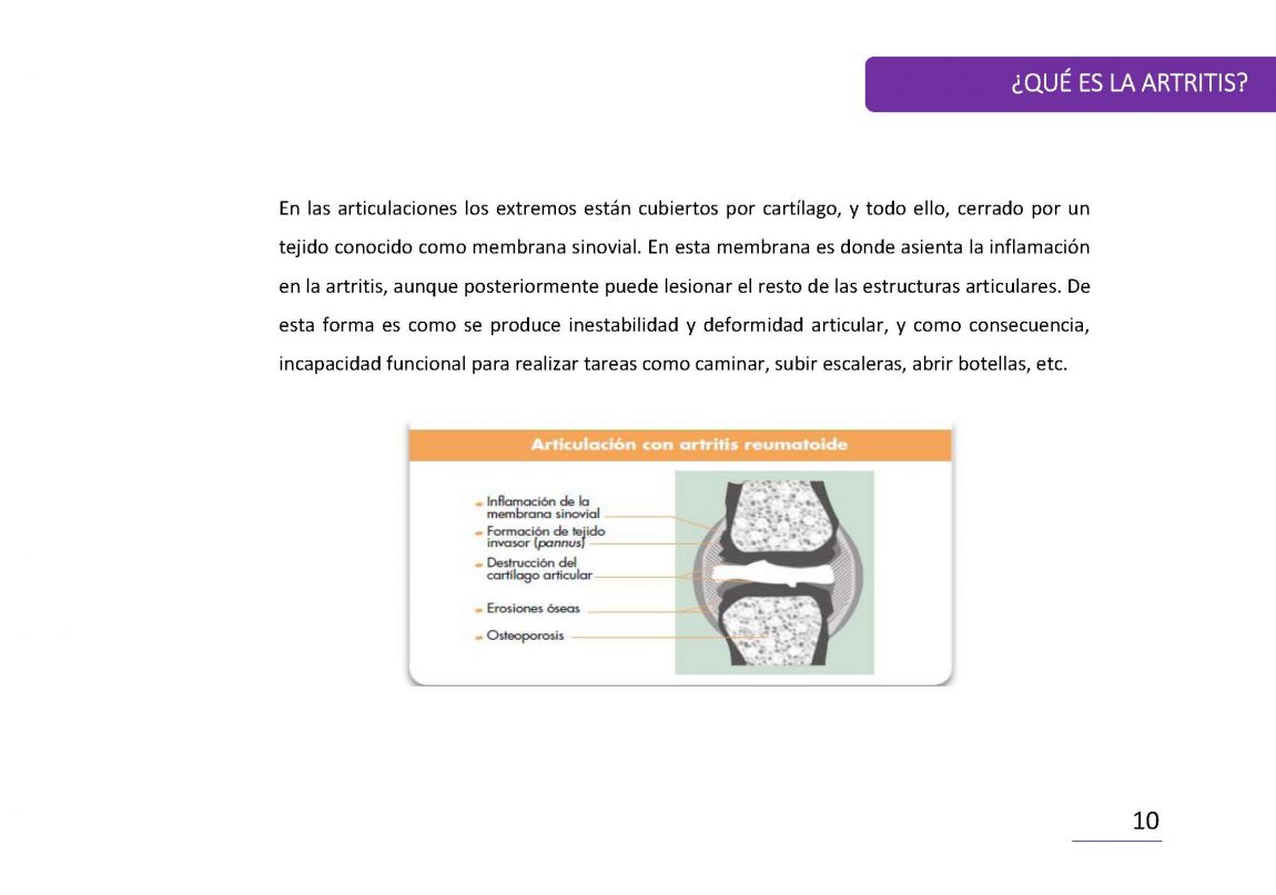 ArtritisReumatoide PaÌgina 10